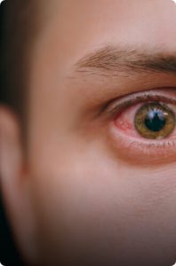 Minimally invasive glaucoma surgery
